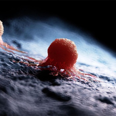 Detail of cancer cells
